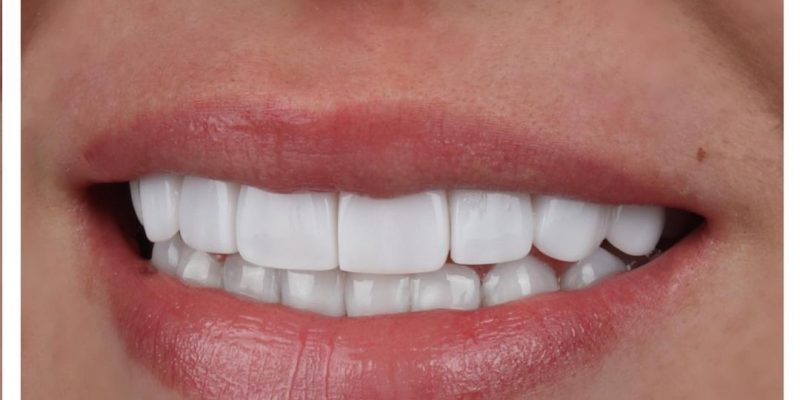 sonrisas